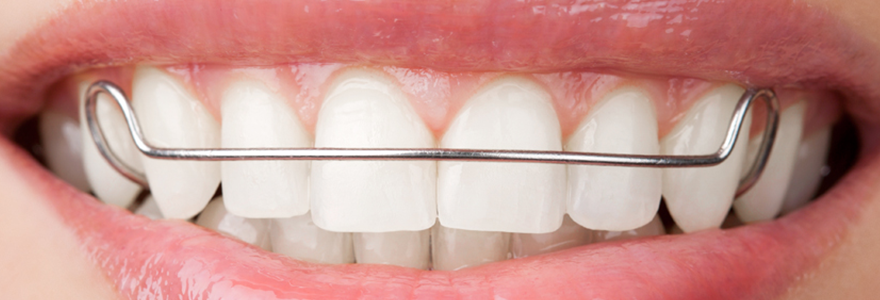 Caring for Teeth with Braces and Retainers