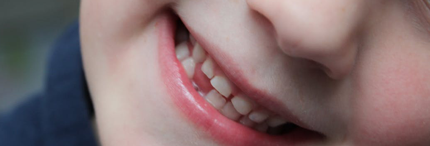 Reducing-The-Risk-of-Tooth-Loss