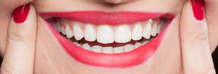 Difference-Between-Overbite-and-Underbite