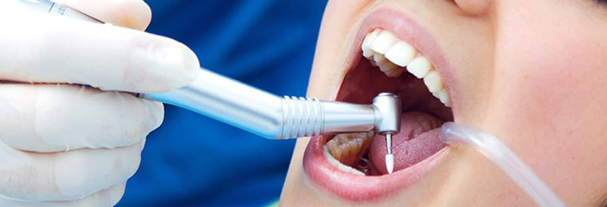 Visiting-a-Dentist-If-You-Have-a-Broken-Tooth
