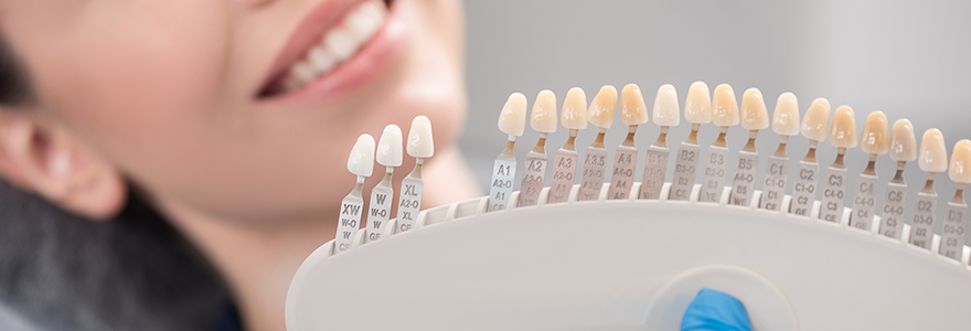 The-Advantages-&-Disadvantages-of-Dental-Veneers