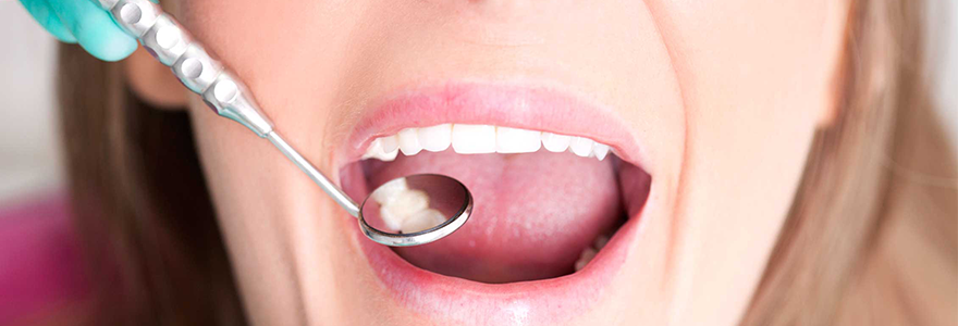 Tips to Reduce Tooth Sensitivity