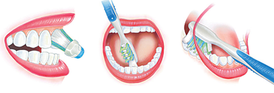 Five-Oral-Hygiene-Practices-You-Might-Be-Doing-Wrong
