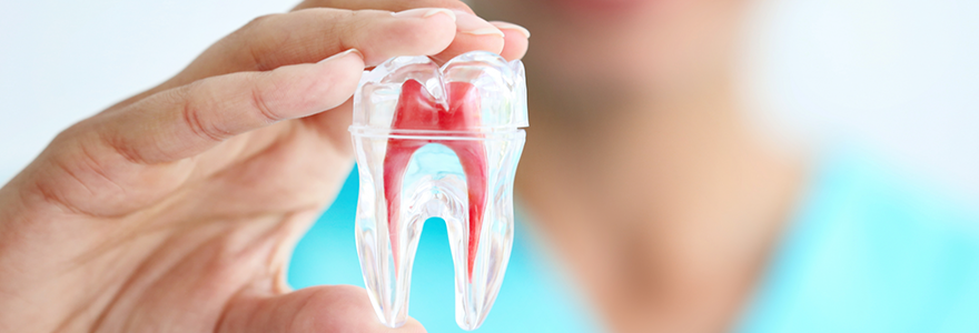 What-is-a-Root-Canal