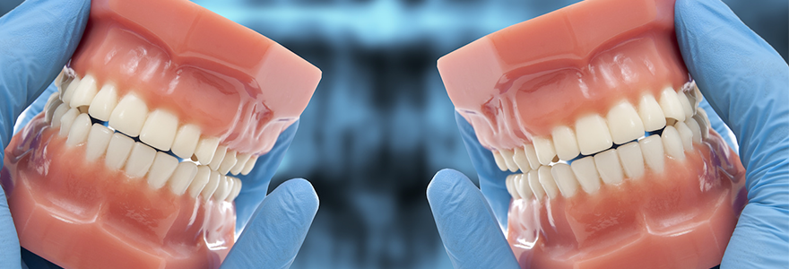Dentures
