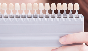 Teeth Whitening In Calgary NW