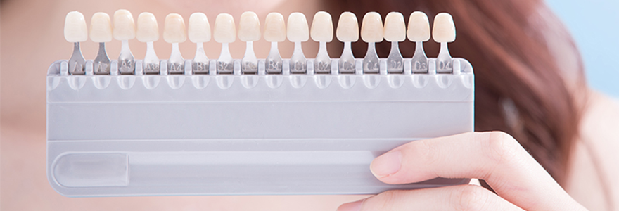 Teeth Whitening In Calgary NW