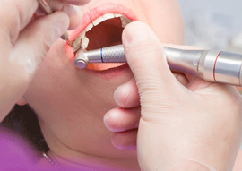 Teeth Cleanings & Checkups in Calgary NW