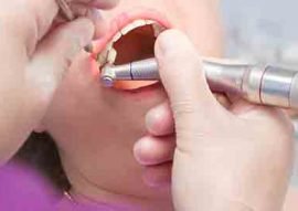 Teeth Cleanings & Checkups in Calgary NW