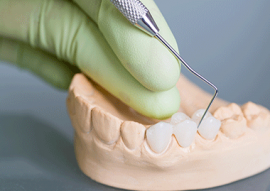 Dental Bridge in Calgary NW