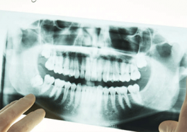 Digital X-rays In Calgary NW