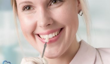 Some Essential Things You Might Not Know About Dental Veneers