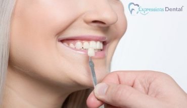 Ways Porcelain Veneers Can Enhance Your Smile