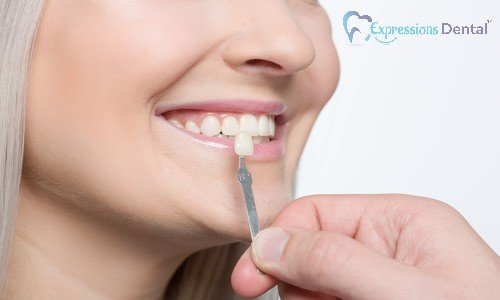 Ways Porcelain Veneers Can Enhance Your Smile